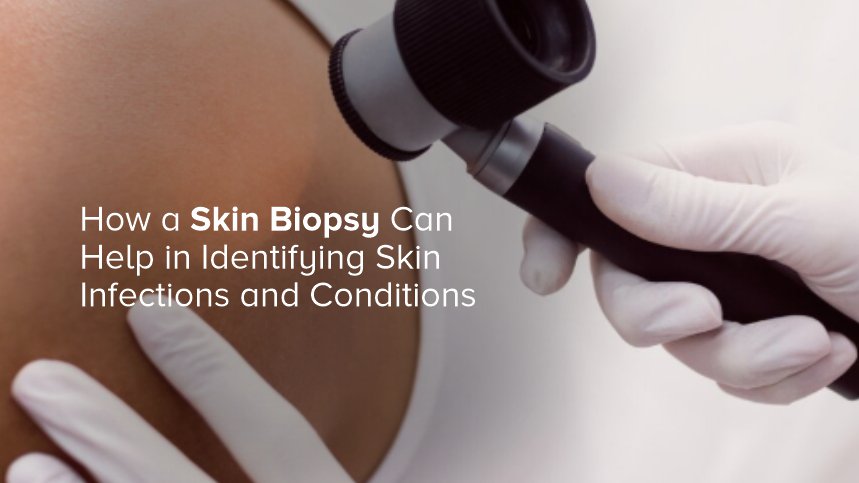 How a Skin Biopsy Can Help in Identifying Skin Infections and Conditions